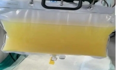 Người đàn ông máu trắng như