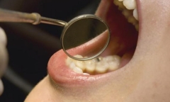 Tin tức đời sống ngày 12/5: Phát hiện bị ung thư sau 6 tháng có khối sùi loét trong miệng