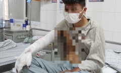 Tin tức đời sống ngày 9/2: Thanh niên bỏng nặng vì bình ga mini phát nổ khi ăn lẩu