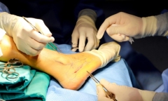 Mắc bệnh cực hiếm gặp, người phụ nữ 34 tuổi bị gãy xương khắp cơ thể, thế giới chưa tới 100 ca