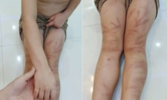 Vụ 6 trẻ mầm non bị đánh bầm tím người ở Nghệ An: Thông tin mới nhất