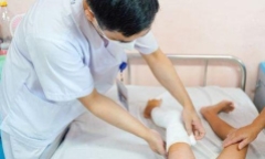 Bé gái 6 năm không đi lại được do chân có khối dị dạng tĩnh mạch