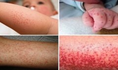 Cách phòng tránh bệnh sốt xuất huyết tại nhà 