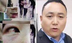 Con gái bị đánh đập dã man, người cha đành nhờ đến sự trợ giúp từ cộng đồng mạng