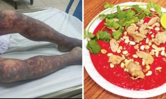 Nam Định: Người đàn ông tử vong sau món tiết canh lợn
