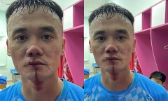 5 HLV và cầu thủ bị VFF xử lý kỷ luật sau trận đấu gây tranh cãi