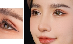 Có nên cắt mắt 2 mí không?