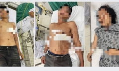 Khánh Hòa: Thanh niên đâm trọng thương 3 người nhà bạn gái trong cuộc nhậu