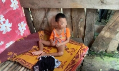 Bé trai 5 tuổi có nhiều vết thương trên cơ thể, phải ở một mình trong lán tạm