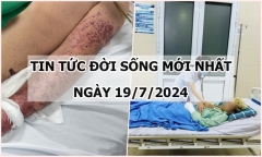 Tin tức đời sống ngày 19/7/2024: Nhập viện sau khi chế biến thủ lợn đãi bạn