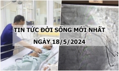 Tin tức đời sống ngày 18/5/2024: Cấp cứu cụ ông 94 tuổi bị nhồi máu cơ tim cấp