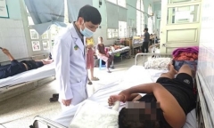 Tin tức đời sống 11/1: Bé trai bỏng nặng, phải nhập viện do chơi pháo tại nhà