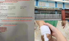 Xác minh vụ giáo viên nghi dùng dụng cụ đánh gãy ngón tay học sinh