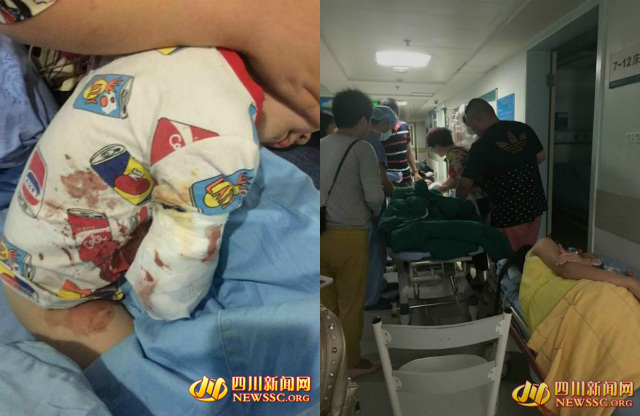 Bé 2 tuổi bị mất cánh tay vì đùa với bạch hổ