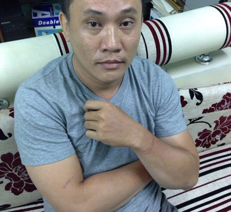 Điều tra vụ người mẫu bán dâm: Chưa thể kết luận