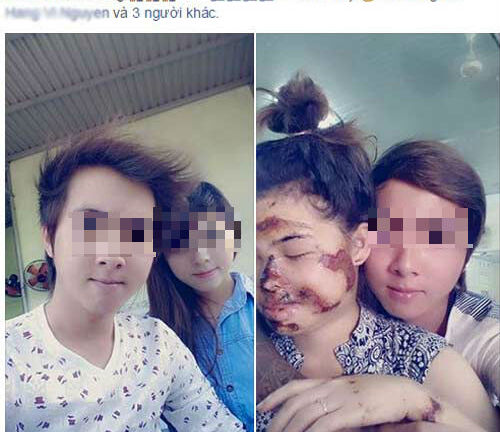 Chàng trai viết status gửi bạn gái mặt bị biến dạng gây xôn xao