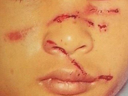 Con trai bị bố đánh dã man vì...làm sổng trâu