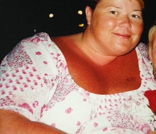 Người phụ nữ nặng 200kg giảm cân vì sợ chồng bỏ