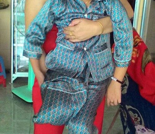 Vụ bé trai 8 tuổi bị cưa chân: Đã có kết luận chính thức