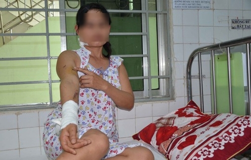 Ba người bị thương vì pháo hoa rơi trúng đầu