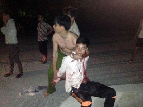 Lào Cai: Chồng đâm vợ tử vong giữa đường rồi tự tử