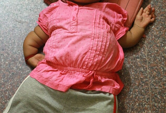 Bệnh lạ khiến thiếu nữ 19 có thân hình của trẻ lên 2