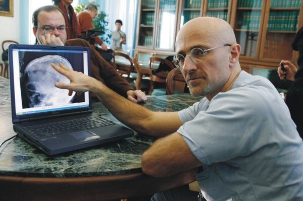 Sắp diễn ra ca phẫu thuật ghép đầu chưa từng có trong lịch sử loài người