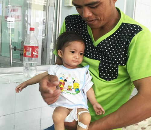 Kỳ lạ bé gái tý hon 18 tháng biết nói nhưng chỉ nặng hơn 3kg