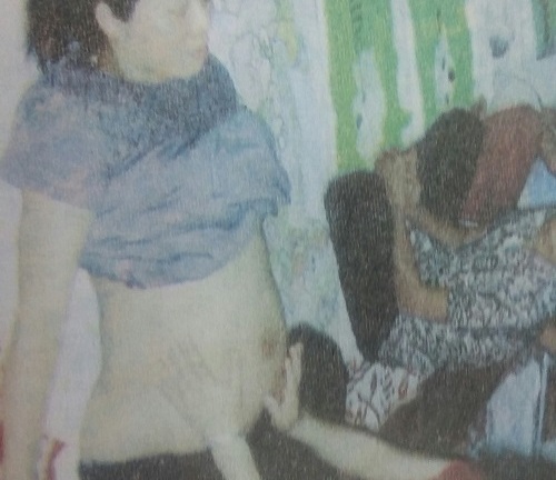 Kỳ lạ chuyện chữa suy thận cho thai nhi bằng tâm linh?