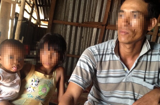 'Hiến' thận lấy 100 triệu, nghèo vẫn hoàn nghèo