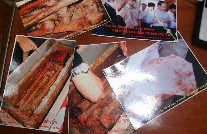 Nhà khoa học lý giải  bộ hài cốt 200 năm chảy máu