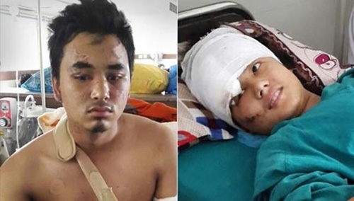 Động đất Nepal: Rơi từ độ cao 60m, cặp tình nhân sống sót kỳ diệu