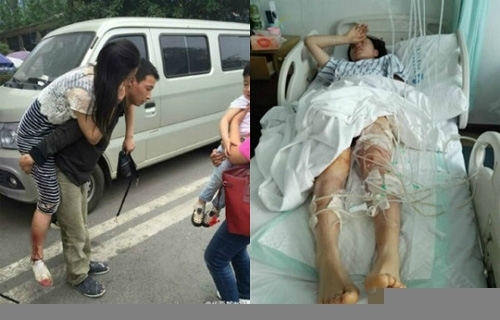 Bảo vệ con trai, người mẹ chịu chó dữ cắn khắp người