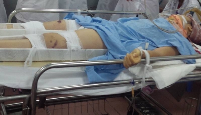 Nữ sinh lớp 8 rơi từ tầng 3 xuống đất ở Hà Nội đã tử vong