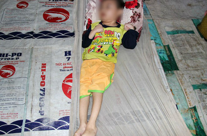 Phẫn nộ với kẻ ném con trai nứt sọ phải nằm liệt giường