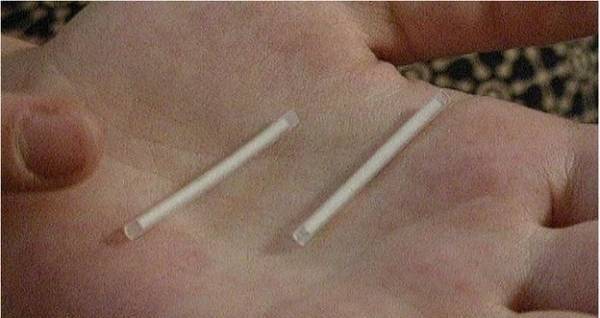 Đặt que cấy tránh thai vẫn mang bầu, được đền bù 1 tỷ đồng