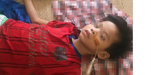 Thương tâm bé 7 tuổi phải cắt bỏ 2/3 dạ dày vì uống nhầm axit