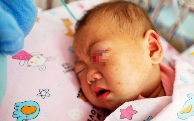 Cãi nhau với người nhà, cha chọc mù mắt con gái 9 tháng tuổi