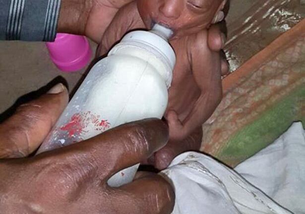 Cha mẹ chối bỏ đứa con 2 tuần tuổi vì hình dạng kỳ dị