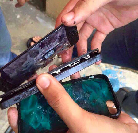 Iphone phát nổ vì trời quá nóng, nam thanh niên bị bỏng nặng