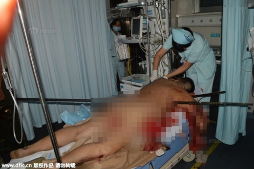 Người đàn ông bị thanh sắt lớn đâm ngang người