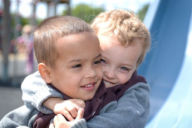 Cặp song sinh mang 2 màu da khác nhau khiến bố mẹ cũng sốc