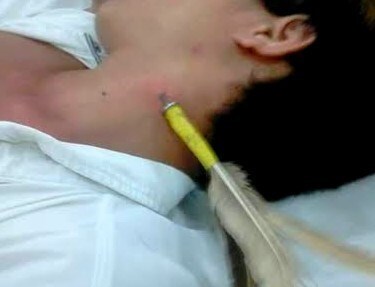 Phóng phi tiêu, phóng nhầm vào cổ quản lý gian hàng