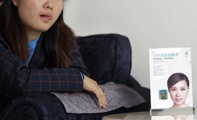 Nhật ký phẫu thuật thẩm mỹ của một nữ sinh bị chê mặt xấu