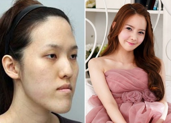 Bị chê quá xấu, cô gái quyết định phẫu thuật thành thiên nga