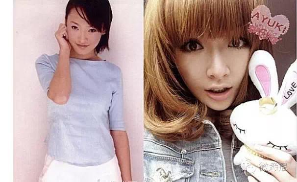 “Không dám tin” chùm ảnh trước và sau phẫu thuật thẩm mỹ của các hot girl