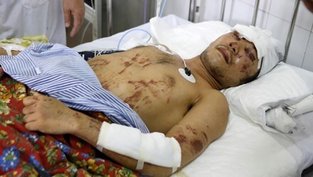 Tang thương 8 người trong một gia đình thiệt mạng