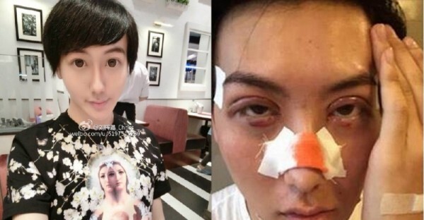Anh chàng có “khuôn mặt yêu tinh” tự tử vì phẫu thuật thẩm mỹ thất bại?