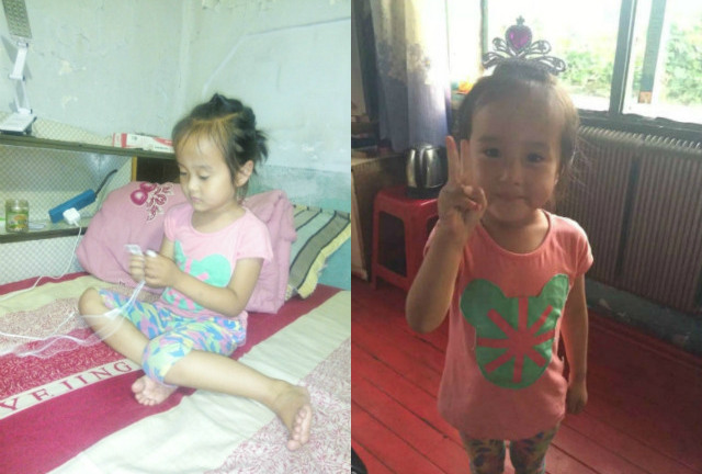 Chuyện lạ: Bé 4 tuổi mắc khối u buồng trứng ác tính