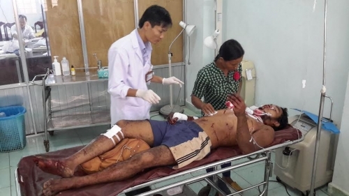 Đắk Nông: 4 thanh niên bị thương do cắt cỏ trúng đầu đạn